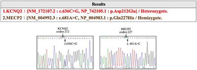 Difficulties of Prenatal Genetic Counseling for a Subsequent Child in a Family With Multiple Genetic Variations